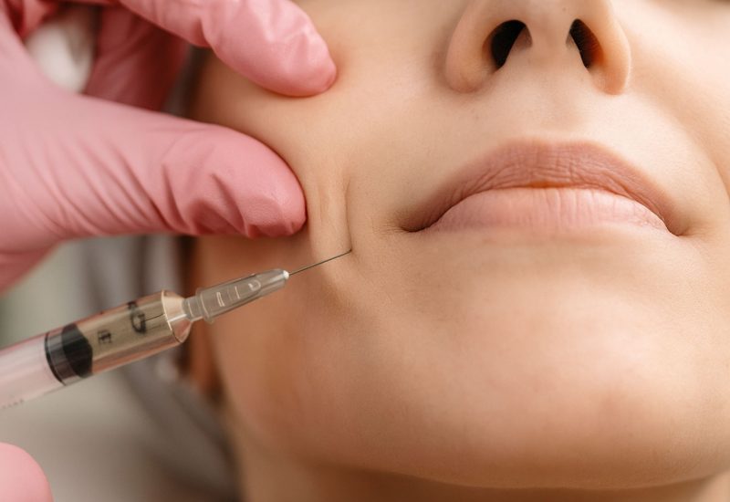 Biostimulators (Sculptra & Radiesse)