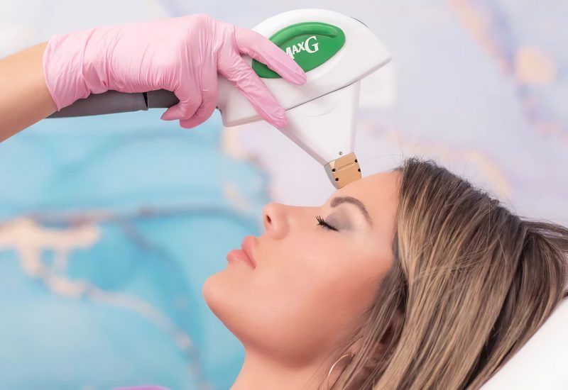 Photo-Rejuvenation IPL